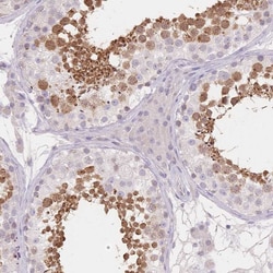 Invitrogen SUV39H2 Polyclonal Antibody 100 &mu;L; Unconjugated:Antibodies,