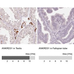 Invitrogen ANKRD31 Polyclonal Antibody 100 &mu;L; Unconjugated:Antibodies,