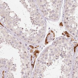 Invitrogen ANKRD31 Polyclonal Antibody 100 &mu;L; Unconjugated:Antibodies,