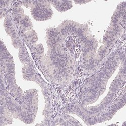 Invitrogen ANKRD31 Polyclonal Antibody 100 &mu;L; Unconjugated:Antibodies,