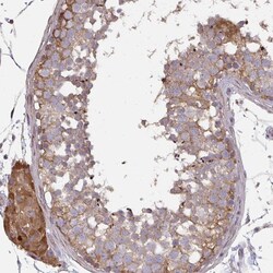 Invitrogen ZFYVE28 Polyclonal Antibody 100 &mu;L; Unconjugated:Antibodies,