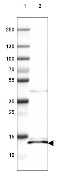 Invitrogen ISCU Polyclonal Antibody 100 &mu;L | Buy Online | Invitrogen&trade; | Fisher Scientific
