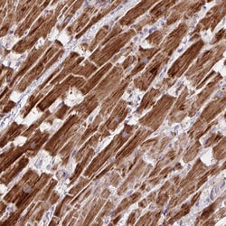 Invitrogen YARS2 Polyclonal Antibody 100 &mu;L; Unconjugated:Antibodies,