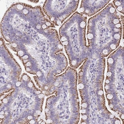 Invitrogen VPS4B Polyclonal Antibody 100 &mu;L; Unconjugated:Antibodies,