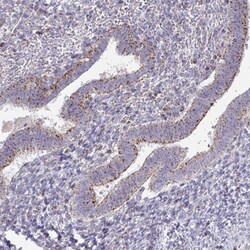 Invitrogen VPS4B Polyclonal Antibody 100 &mu;L; Unconjugated:Antibodies,
