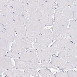 Invitrogen VPS4B Polyclonal Antibody 100 &mu;L; Unconjugated:Antibodies,
