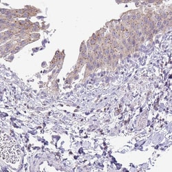 Invitrogen VPS4B Polyclonal Antibody 100 &mu;L; Unconjugated:Antibodies,