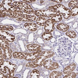 Invitrogen RNF183 Polyclonal Antibody 100 μL; Unconjugated:Antibodies,