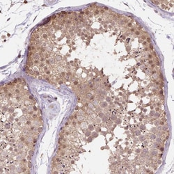 Invitrogen NUDT10 Polyclonal Antibody 100 &mu;L; Unconjugated:Antibodies,