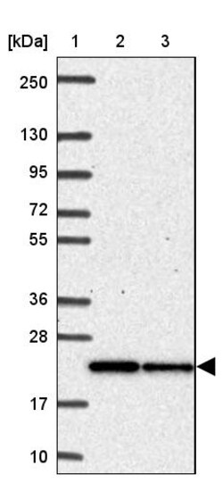 Invitrogen MRPL11 Polyclonal Antibody 100 &mu;L | Buy Online | Invitrogen&trade; | Fisher Scientific