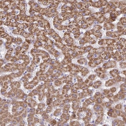 Invitrogen ACSM2A Polyclonal Antibody 100 &mu;L; Unconjugated:Antibodies,