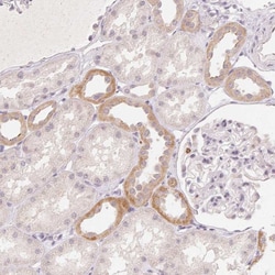 Invitrogen CLCNKA Polyclonal Antibody 100 &mu;L; Unconjugated:Antibodies,