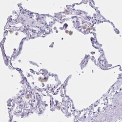 Invitrogen Lymphotactin Polyclonal Antibody 100 &mu;L; Unconjugated:Antibodies,