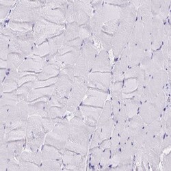 Invitrogen Lymphotactin Polyclonal Antibody 100 &mu;L; Unconjugated:Antibodies,