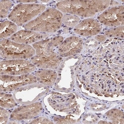Invitrogen C5orf24 Polyclonal Antibody 100 &mu;L; Unconjugated:Antibodies,