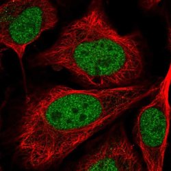 Invitrogen C5orf24 Polyclonal Antibody 100 &mu;L; Unconjugated:Antibodies,