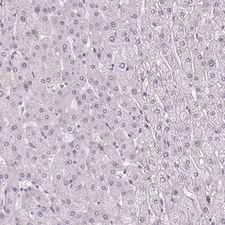 Invitrogen CYP11B2 Polyclonal Antibody 100 &mu;L; Unconjugated:Antibodies,