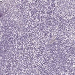 Invitrogen CYP11B2 Polyclonal Antibody 100 &mu;L; Unconjugated:Antibodies,