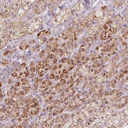 Invitrogen CYP11B2 Polyclonal Antibody 100 &mu;L; Unconjugated:Antibodies,