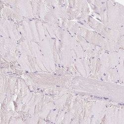 Invitrogen CYP11B2 Polyclonal Antibody 100 &mu;L; Unconjugated:Antibodies,
