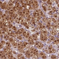 Invitrogen CYP11B2 Polyclonal Antibody 100 &mu;L; Unconjugated:Antibodies,
