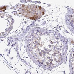 Invitrogen COA5 Polyclonal Antibody 100 &mu;L; Unconjugated:Antibodies,