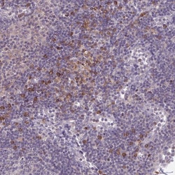 Invitrogen CD1e Polyclonal Antibody 100 &mu;L; Unconjugated:Antibodies,