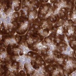 Invitrogen RPS15 Polyclonal Antibody 100 &mu;L; Unconjugated:Antibodies,