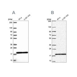 Invitrogen RPS15 Polyclonal Antibody 100 &mu;L; Unconjugated:Antibodies,