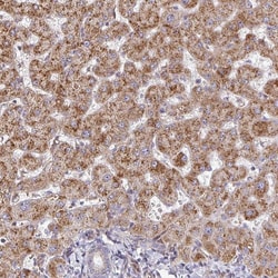Invitrogen ZNF644 Polyclonal Antibody 100 &mu;L; Unconjugated:Antibodies,