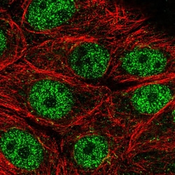Invitrogen MORN2 Polyclonal Antibody 100 &mu;L; Unconjugated:Antibodies,