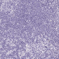 Invitrogen S100A7L2 Polyclonal Antibody 100 &mu;L; Unconjugated:Antibodies,