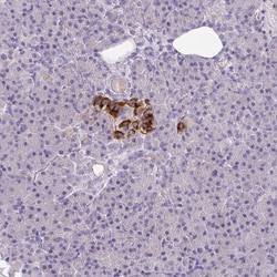 Invitrogen S100A7L2 Polyclonal Antibody 100 &mu;L; Unconjugated:Antibodies,