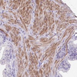 Invitrogen S100A7L2 Polyclonal Antibody 100 &mu;L; Unconjugated:Antibodies,