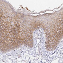 Invitrogen ZDHHC11B Polyclonal Antibody 100 &mu;L; Unconjugated:Antibodies,