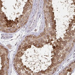 Invitrogen RANGRF Polyclonal Antibody 100 &mu;L; Unconjugated:Antibodies,