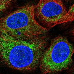 Invitrogen SARDH Polyclonal Antibody 100 &mu;L; Unconjugated:Antibodies,