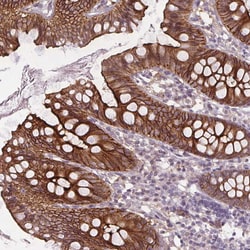 Invitrogen SLC26A2 Polyclonal Antibody 100 &mu;L; Unconjugated:Antibodies,