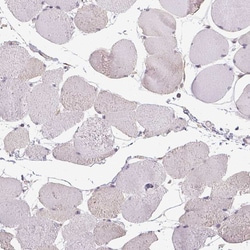 Invitrogen SLC26A2 Polyclonal Antibody 100 &mu;L; Unconjugated:Antibodies,