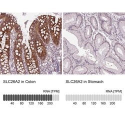 Invitrogen SLC26A2 Polyclonal Antibody 100 &mu;L; Unconjugated:Antibodies,