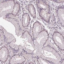 Invitrogen SLC26A2 Polyclonal Antibody 100 &mu;L; Unconjugated:Antibodies,