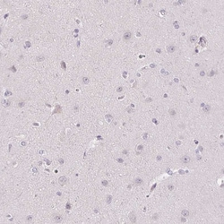 Invitrogen TMEM52B Polyclonal Antibody 100 &mu;L; Unconjugated:Antibodies,