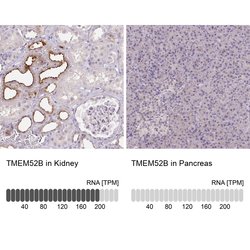 Invitrogen TMEM52B Polyclonal Antibody 100 &mu;L; Unconjugated:Antibodies,