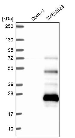 Invitrogen TMEM52B Polyclonal Antibody 100 &mu;L; Unconjugated:Antibodies,