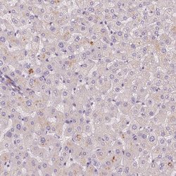 Invitrogen FAM53A Polyclonal Antibody 100 &mu;L | Buy Online | Invitrogen&trade; | Fisher Scientific