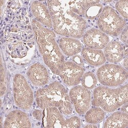 C10orf128 Polyclonal Antibody:Antibodies, Polyclonal