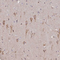 Invitrogen B4GALT6 Polyclonal Antibody 100 &mu;L; Unconjugated:Antibodies,