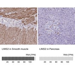 Invitrogen LIMS2 Polyclonal Antibody 100 &mu;L; Unconjugated:Antibodies,