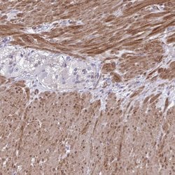 Invitrogen LIMS2 Polyclonal Antibody 100 &mu;L; Unconjugated:Antibodies,