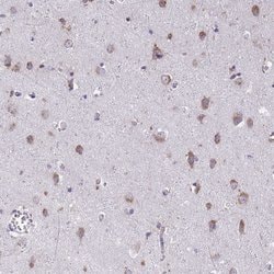 Invitrogen TMEM106B Polyclonal Antibody 100 &mu;L | Buy Online | Invitrogen&trade; | Fisher Scientific